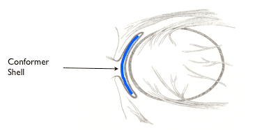 The Operation: Eye Enucleation, Fitting of the Orbital Implant and ...