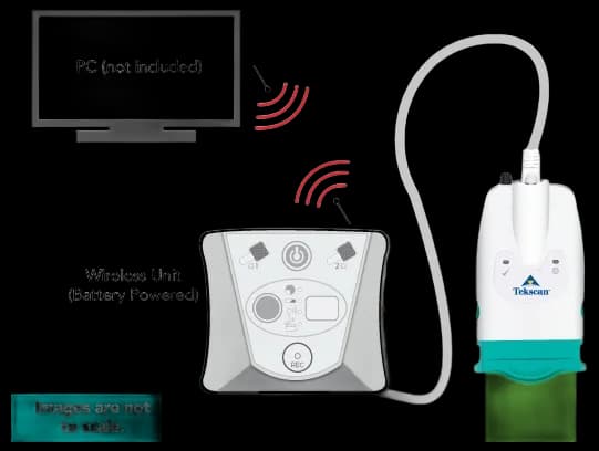 Hoof Pressure Measurement | Hoof System | Tekscan