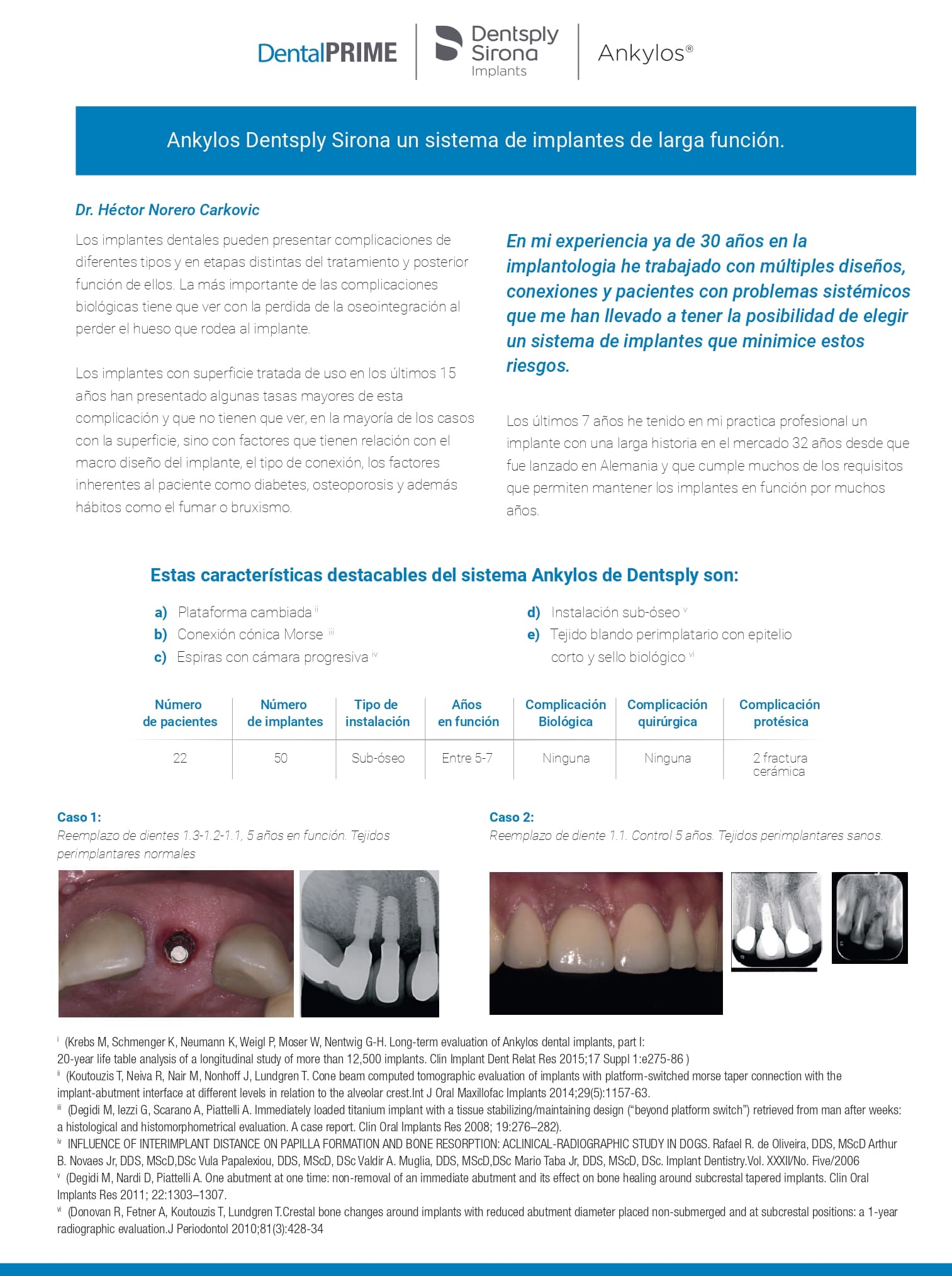 Ankylos Dentsply Sirona un sistema de implantes de larga función ...