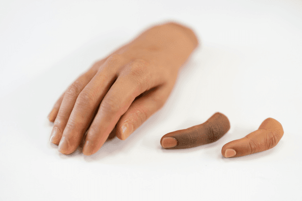 Functional Thumb Prosthetics Near You in the USA