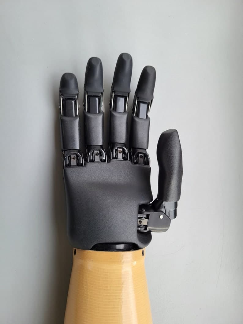Prosthetic Arm - Vincent Evolution 3 - German Prosthetic Arm - New ...
