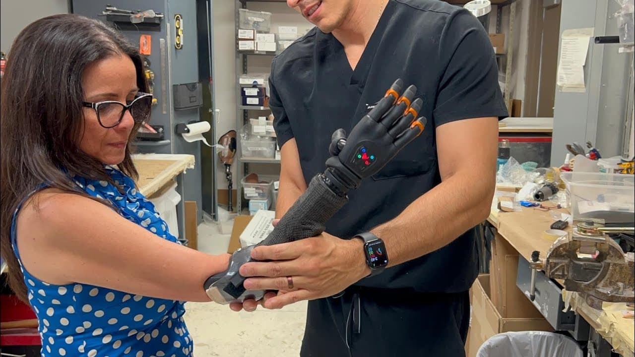 Delivering The Vincent Evolution 5 Bionic Prosthetic Hand: Why Fitting ...