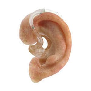 Auricular cosmetic prosthesis - The Anaplastology Clinic - adult