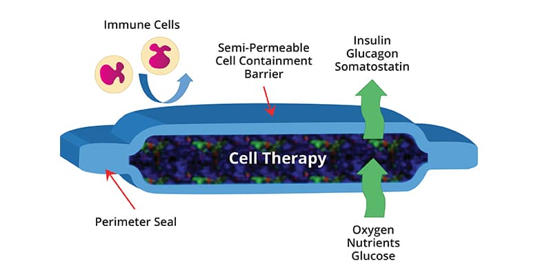 Will ViaCyte’s Encaptra Cell Delivery System ‘Cure’ Type 1 Diabetes ...