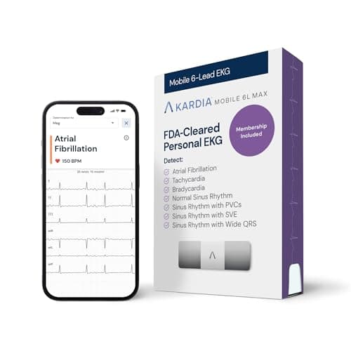 AliveCor Kardia Mobile 6L - Portable Personal EKG Monitor for Home ...