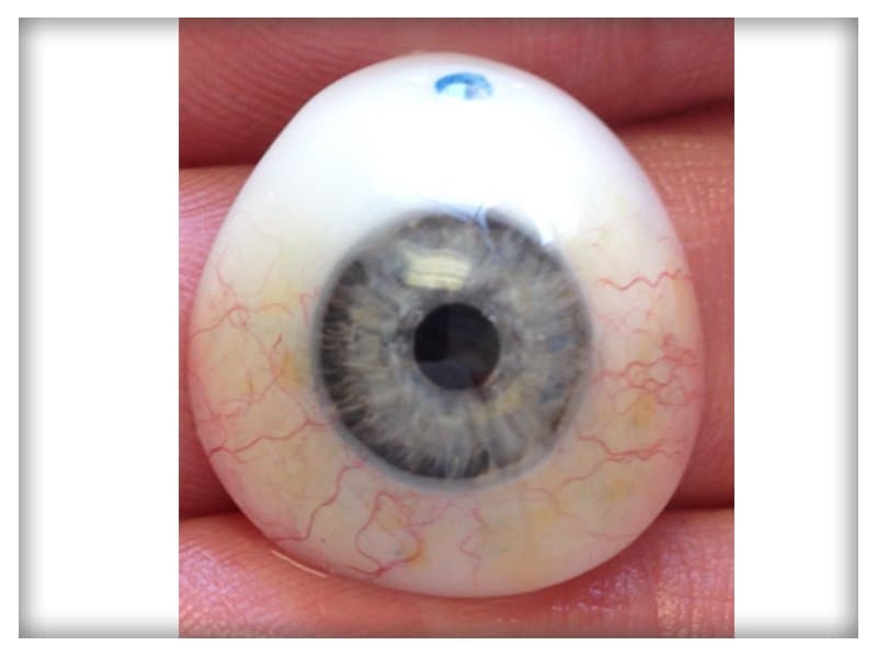 Before & After Toronto Eye Prosthetic Image Gallery - Hall & Associates ...
