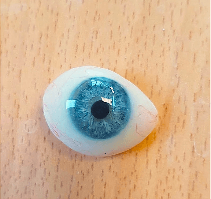 Private Ocular Prosthetics in Essex | Custom Prosthetic Eyes and ...