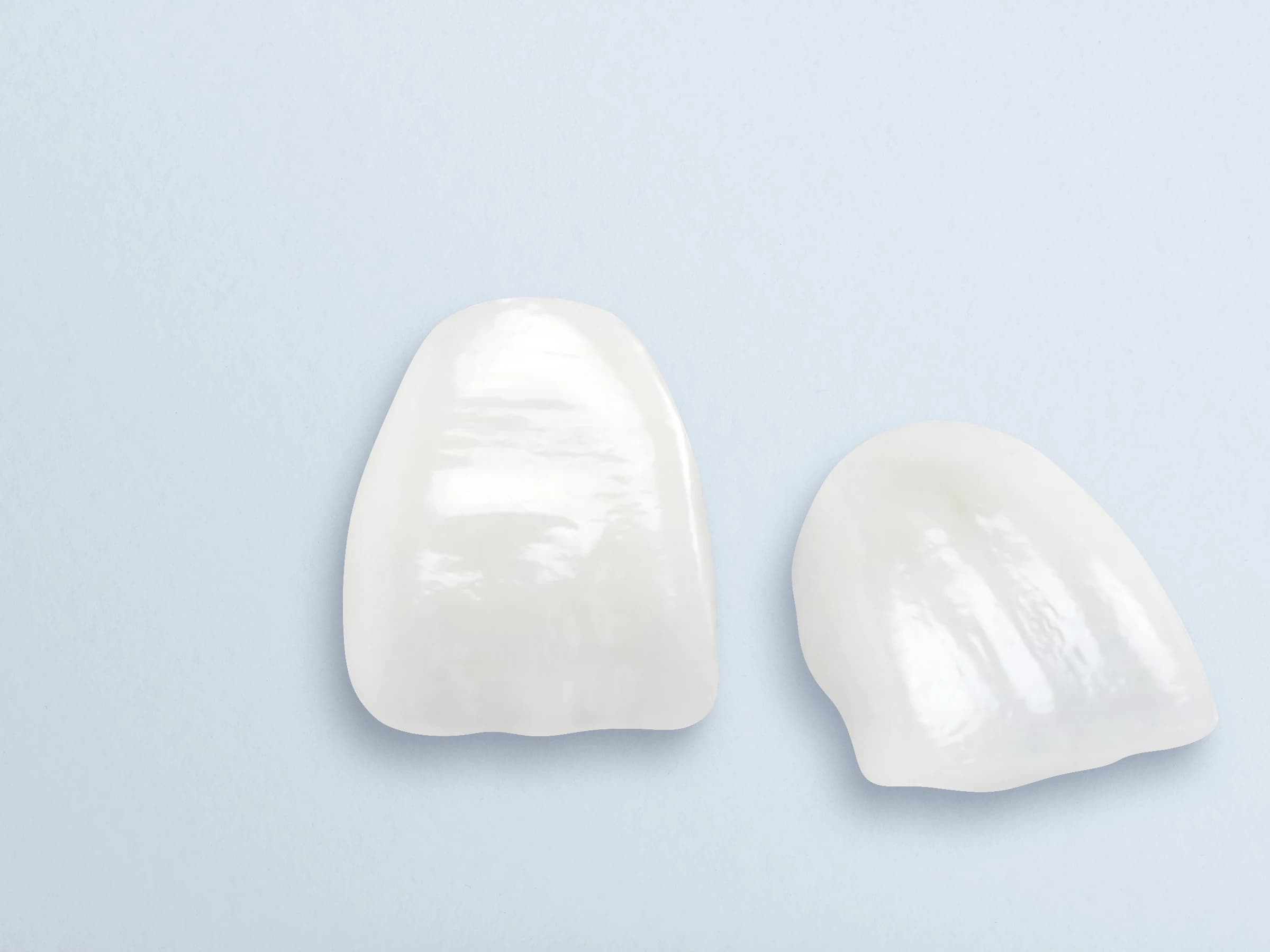 Lumineers by DenMat Cerinate Porcelain Veneers