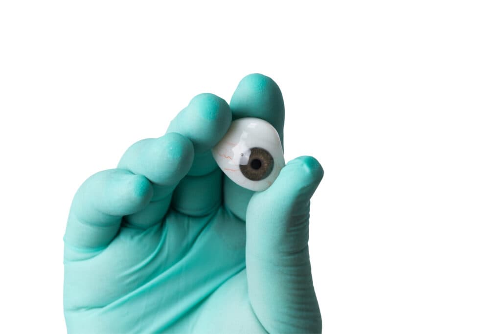Prothèse Oculaire : Prothésistes Oculaires à Caen - LCS