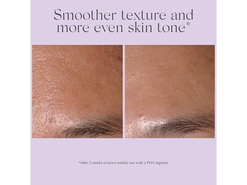 Exuviance Performance Peel AP25: use this at-home chemical peel.