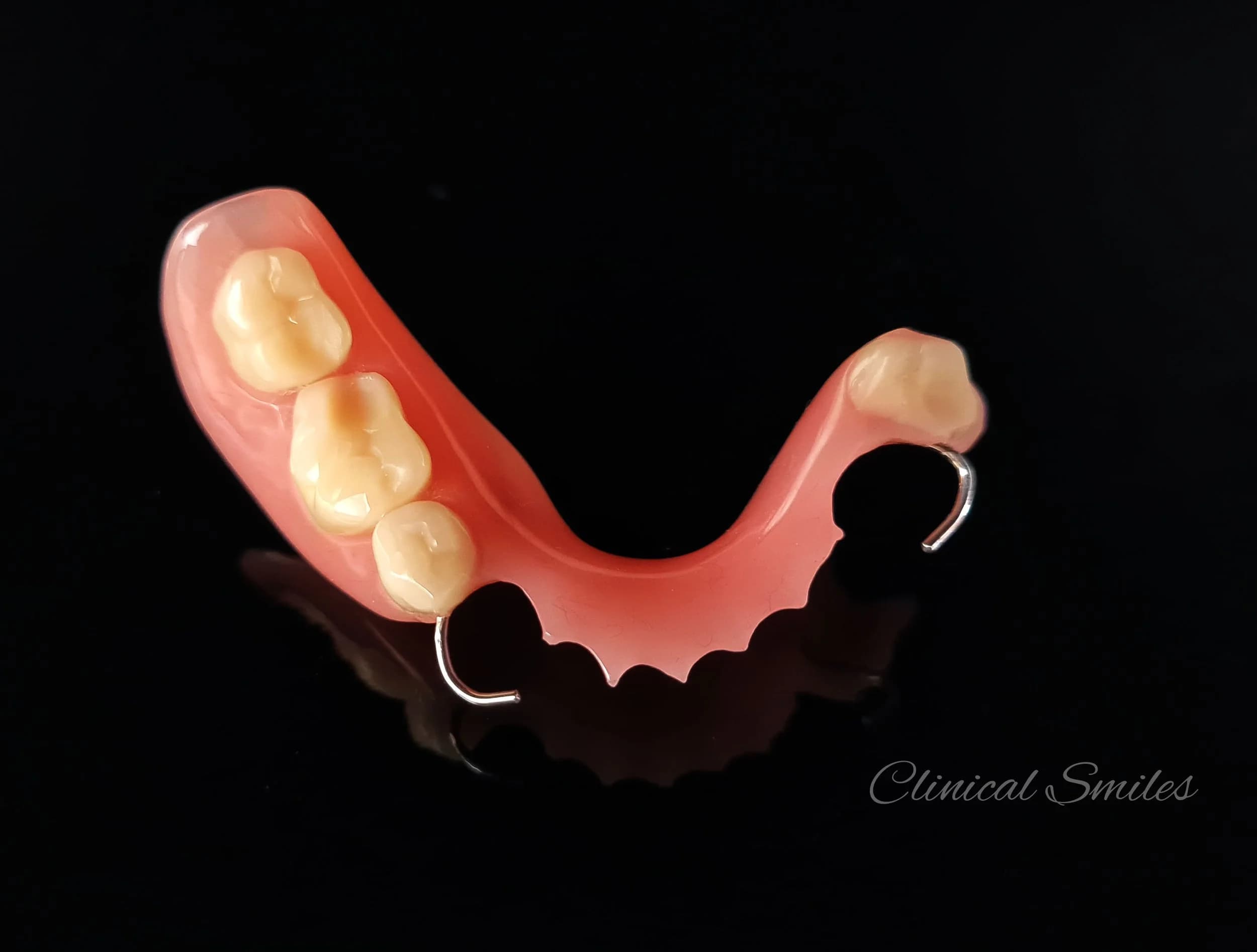 Acrylic Partial Dentures Auckland — Clinical Smiles Denture Clinic