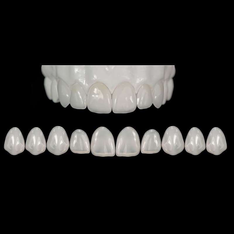 Edelweiss Veneers - Marletta Enterprises