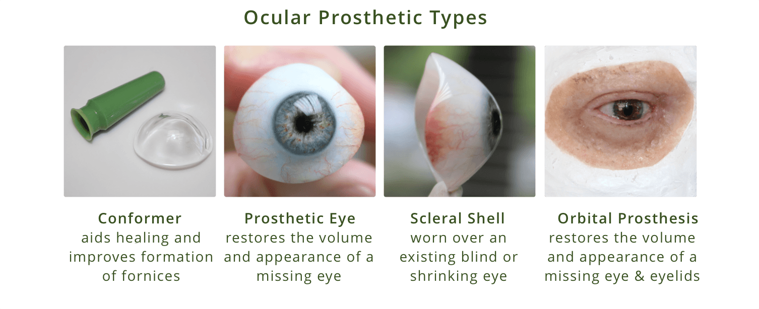 Eye Conditions and Solutions with Northwest Eye Design