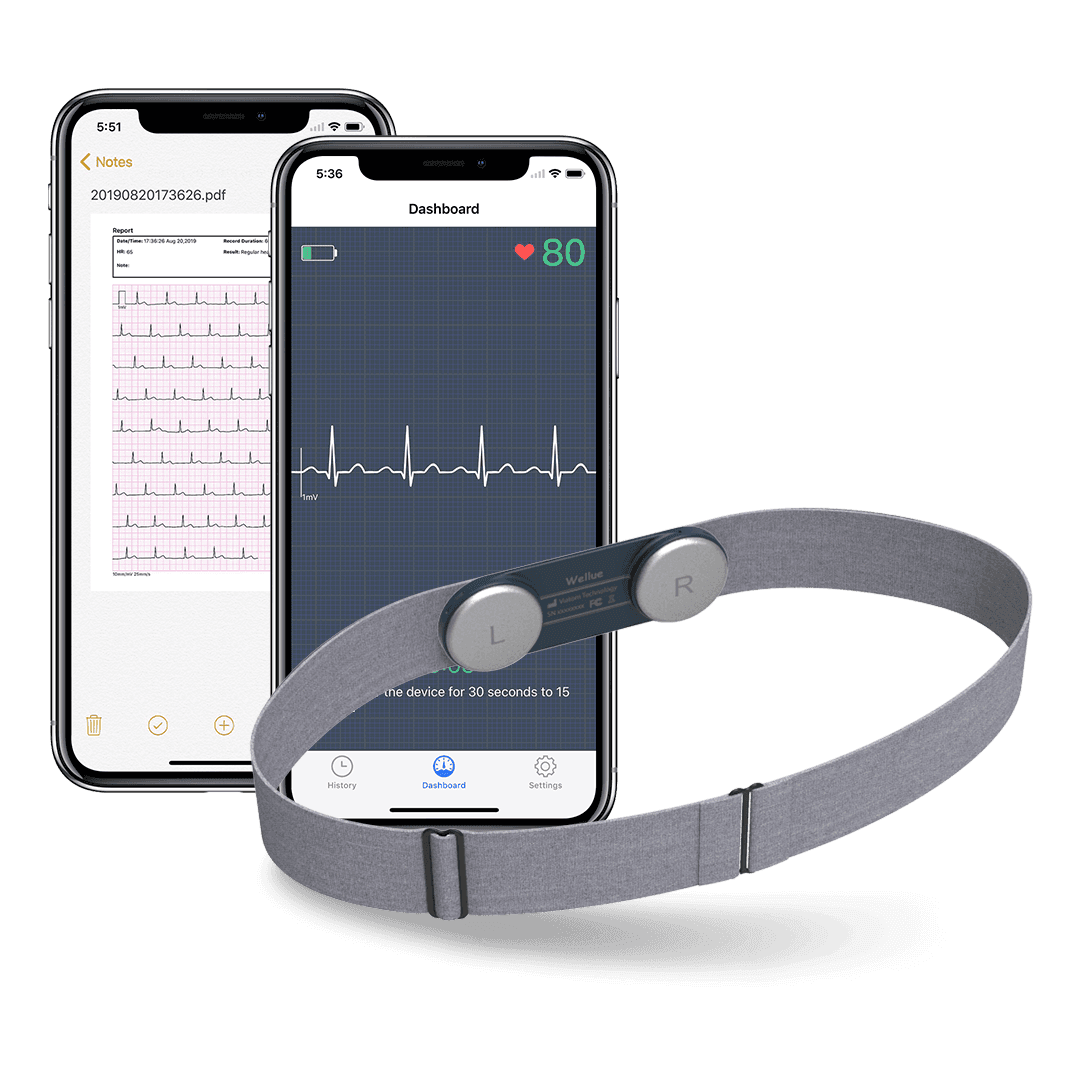 Moniteur ECG portable DUOEK™ – Ranealth