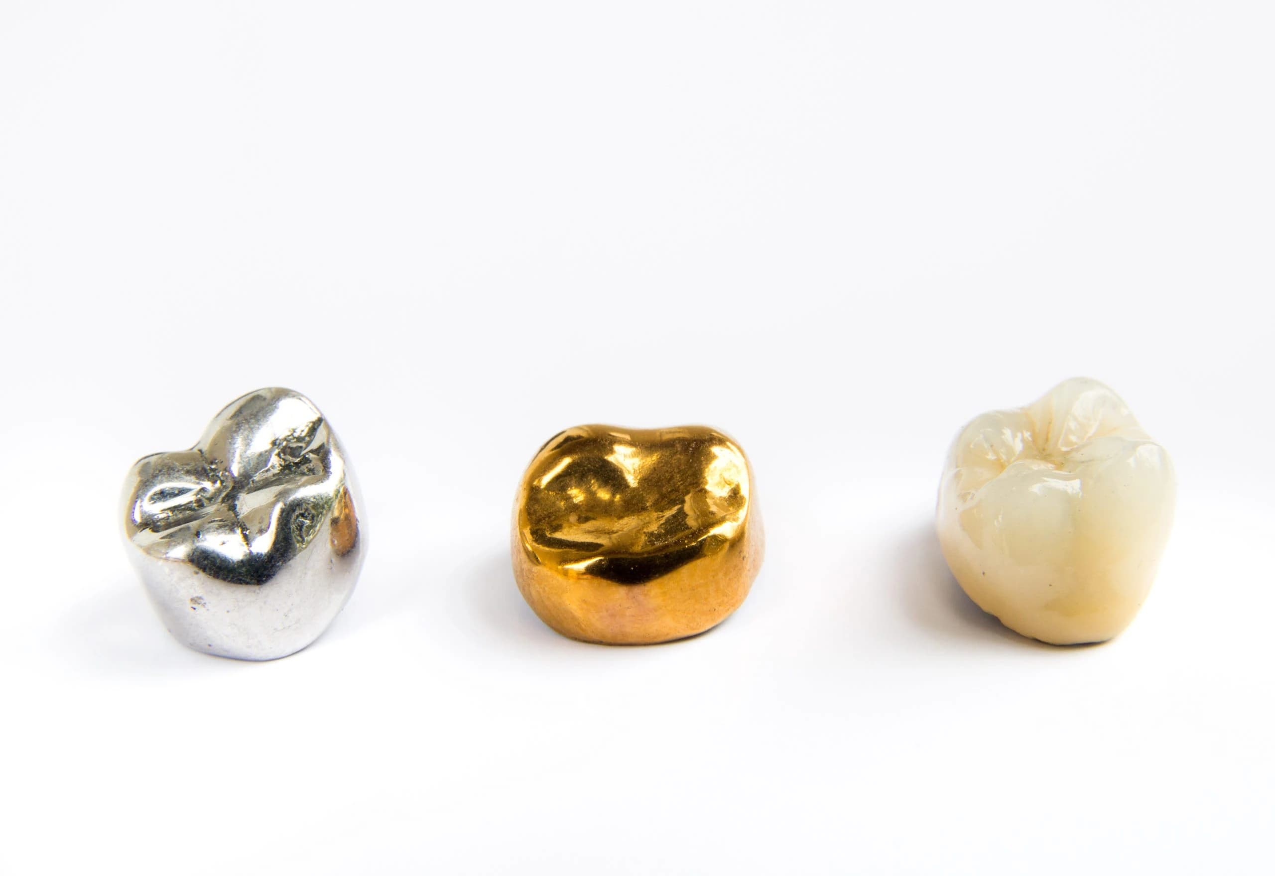 Gold Crown Tooth Benefits & Comparison