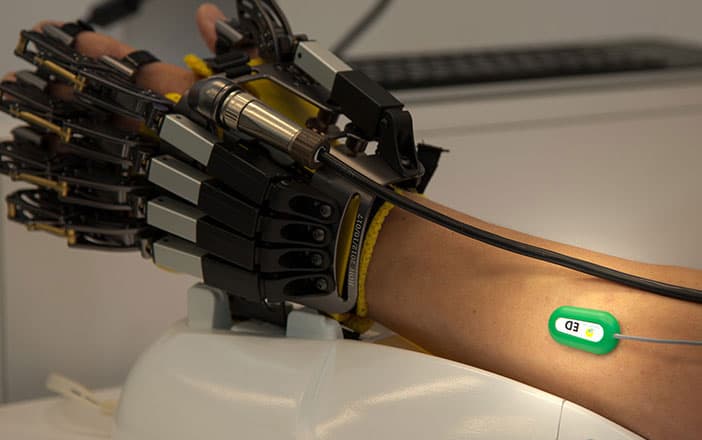 Hand of Hope: Robotic Arm for Stroke Rehab - Robotic Gizmos